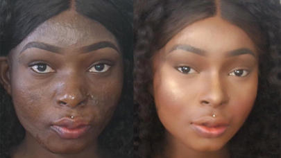 Üzü yanan qadın makiyajın gücünü belə sübut etdi - VİDEO