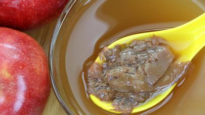 Üzünüzü alma sirkəsi ilə silin ki...