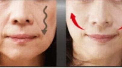 Sallanmış yanaqlardan xilas olmağın yolları