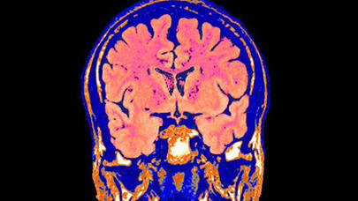 İnqilabi YENİLİK: Ölünü dirildəcəklər