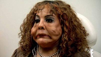 Üzünə sement vurdurdu, eybəcər hala düşdü – FOTOLAR