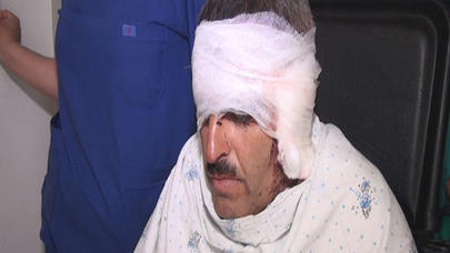 Namus üstündə qulaqlarını kəsdi - Lerikdəki cinayətin TƏFƏRRÜATI