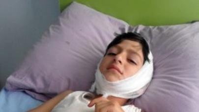 Ağdamda 3-cü sinif şagirdini maşın vurub