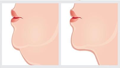 Buxağı yox edən maska