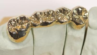 Bakıda diş həkimindən 38 diş oğurladılar