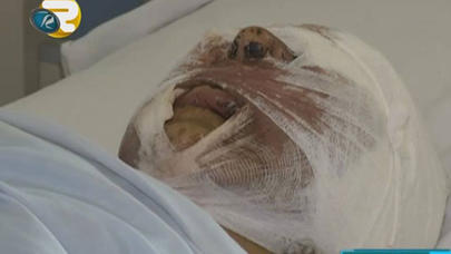 Çaqqal sürüsü qadına hücum etdi - VİDEO