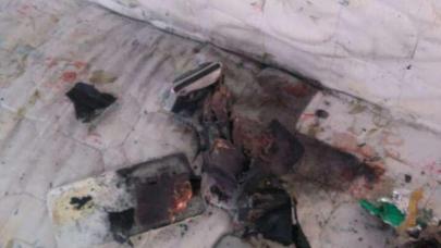 Bakı sakininin telefonu partladı, uşağın dili tutuldu - FOTO