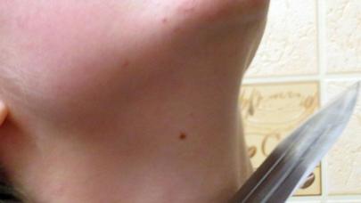 Gəncədə qanlı OLAY: Ər arvadını öldürdü, baldızını xəstəxanalıq etdi