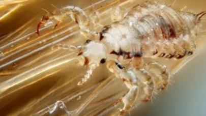 Gözəllik uğruna bunu da etdilər: bitlə...