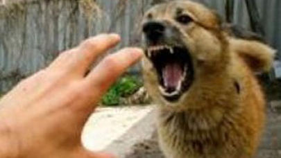 65 yaşlı kişini it dişləyib