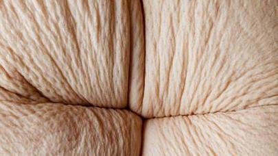 Arıqlayıb bu günə düşdü – FOTOLAR