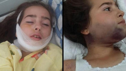 Binəqədidə ŞOK - Çiynində əjdaha şəkli olanlar azyaşlını binadan atdı - FOTOLAR