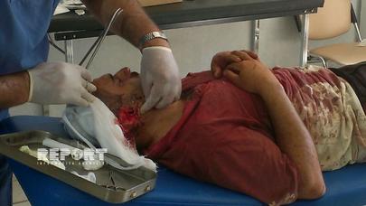 Lerikdə olay: qonşular dava zamanı bir nəfərin hər iki qulağını kəsdilər - FOTOLAR