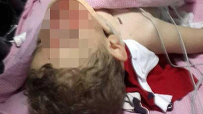 29 yaşlı qız ağacdan yıxıldı - ŞƏMKİRDƏ