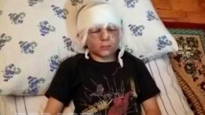 Tərtərdə hərbi sursat partladı: azyaşlı xəsarət aldı (YENİLƏNİB)